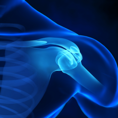 The Best Exercises and Stretches to Help Prevent Rotator Cuff Injuries